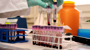 A lab technician works on blood samples collected for anti-doping purposes (Image: AAP)