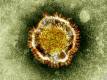 New case of virus in Saudi Arabia