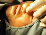 Cosmetic surgery on the rise in Afghanistan