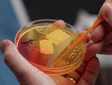 Senate inquiry calls for urgent action on superbugs