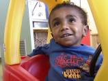 Life-changing surgery for PNG toddler