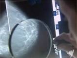 'Action needed' to cut women's BPA exposure