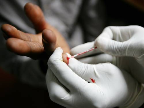 The study's findings may be particularly important at a time when improved drug treatments have allowed more HIV/AIDS infected people to live longer. (Getty)