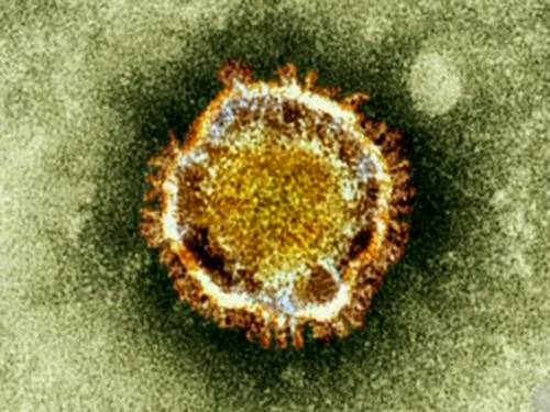 A new case of the deadly coronavirus has been detected in Saudi Arabia. (AAP)