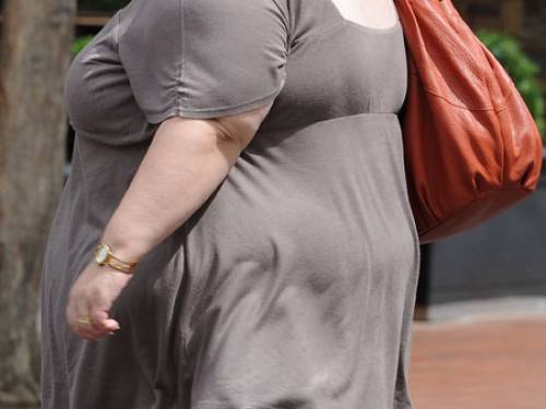 Less than a quarter of Australians in a survey were deemed to be of normal healthy weight, with 32.4 per cent considered overweight and 42.9 per cent rated as obese. (File AAP)