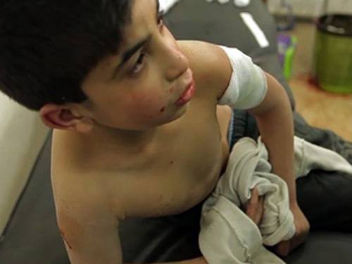 A wounded boy in a Syrian hospital. (BBC)