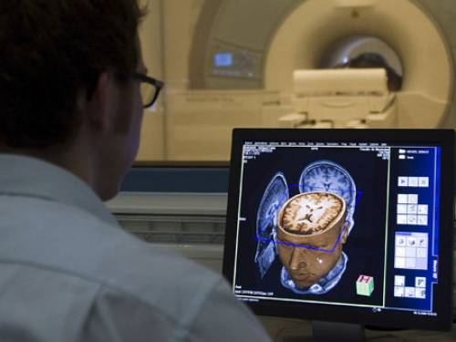 Magnetic Resonance Imaging from the Brain and Behaviour Laboratory in Geneva, Switzerland. Japanese scientists may now take such technology even further. (AAP)