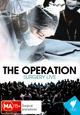 The Operation: Surgery Live (DVD)